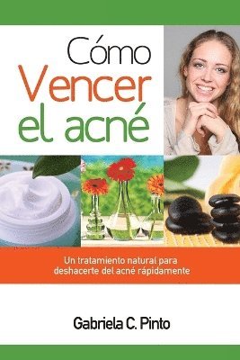 bokomslag Cómo Vencer el Acné: Un tratamiento natural para deshacerte del acné rápidamente