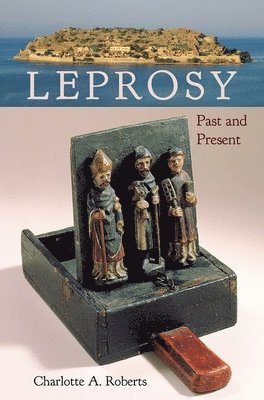 Leprosy 1