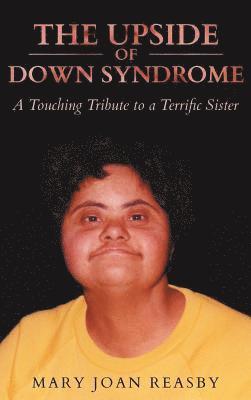 The Upside of Down Syndrome 1