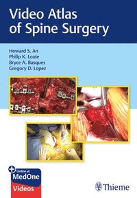 bokomslag Video Atlas of Spine Surgery