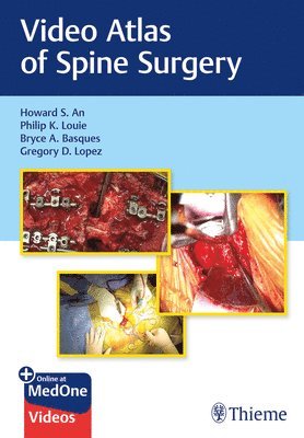 Video Atlas of Spine Surgery 1