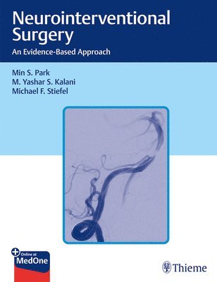 Neurointerventional Surgery 1