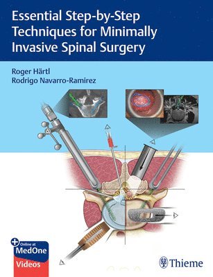 bokomslag Essential Step-by-Step Techniques for Minimally Invasive Spinal Surgery