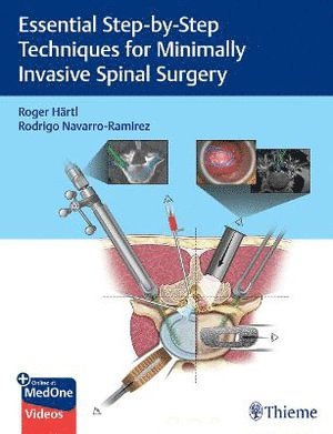 Roger Hartl, Rodrigo Navarro-Ramirez - Essential Step-by-Step Techniques for Minimally Invasive Spinal Surgery, Inbunden