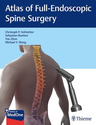 Atlas of Full-Endoscopic Spine Surgery 1