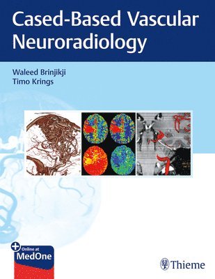 bokomslag Imaging in Neurovascular Disease