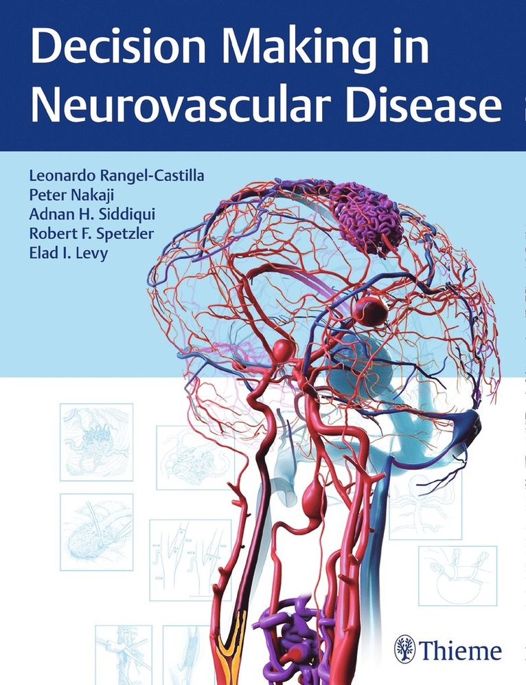 Leonardo Rangel-Castilla, Peter Nakaji, Adnan H. Siddiqui, Robert F. Spetzler, Elad I. Levy, Adnan H Siddiqui, Robert F Spetzler, Elad I Levy - Decision Making in Neurovascular Disease, Inbunden