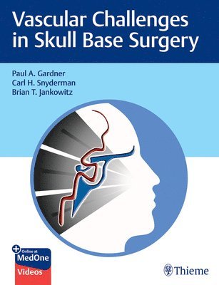 bokomslag Vascular Challenges in Skull Base Surgery