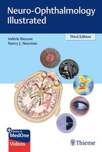 bokomslag Neuro-Ophthalmology Illustrated