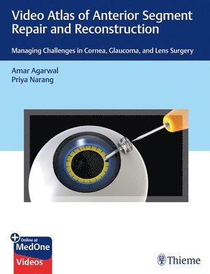 bokomslag Video Atlas of Anterior Segment Repair and Reconstruction