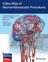 bokomslag Video Atlas of Neuroendovascular Procedures