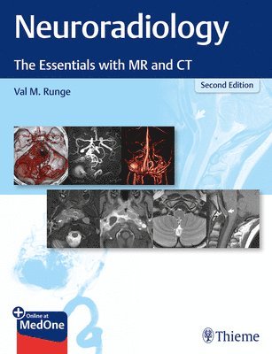 Neuroradiology 1