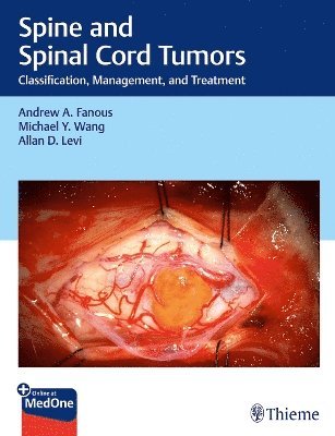 bokomslag Spine and Spinal Cord Tumors: Classification, Management, and Treatment