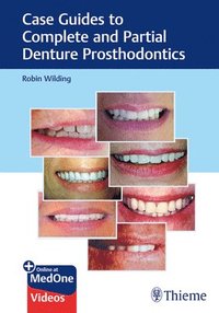 bokomslag Case Guides to Complete and Partial Denture Prosthodontics