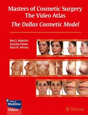 Masters of Cosmetic Surgery - The Video Atlas 1