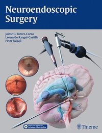 bokomslag Neuroendoscopic Surgery