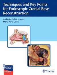 bokomslag Techniques and Key Points for Endoscopic Cranial Base Reconstruction