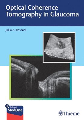 bokomslag Optical Coherence Tomography in Glaucoma