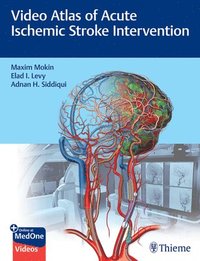 bokomslag Video Atlas of Acute Ischemic Stroke Intervention