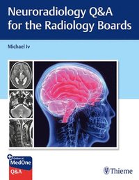 bokomslag Neuroradiology Q&A for the Radiology Boards