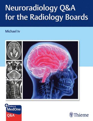 bokomslag Neuroradiology Q&a for the Radiology Boards