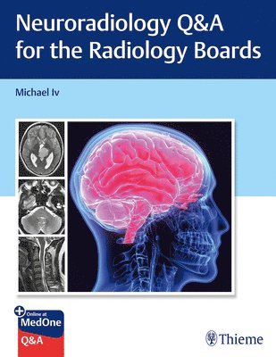 bokomslag Neuroradiology Q&A for the Radiology Boards