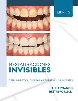 Juan Fernando Restrepo - Restauraciones Invisibles, Häftad
