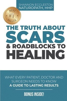 The Truth About Scars and Roadblocks to Healing: What Every Patient, Doctor, and Surgeon Needs to Know 1