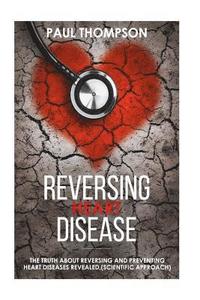 bokomslag Reversing heart disease: The truth about reversing and preventing heart diseases revealed(scientific approach)