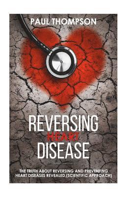Reversing heart disease: The truth about reversing and preventing heart diseases revealed(scientific approach) 1