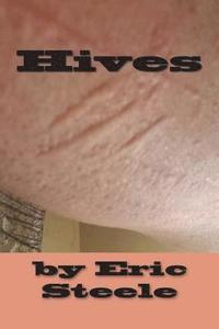 bokomslag Hives