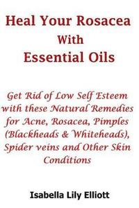 bokomslag Heal Your Rosacea with Essential Oils: Get Rid of Low Self Esteem with these Natural Remedies for Acne, Rosacea, Pimples (Blackheads & Whiteheads), Sp