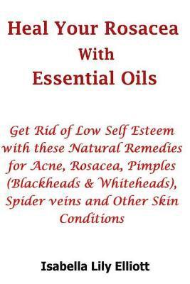 Heal Your Rosacea with Essential Oils: Get Rid of Low Self Esteem with these Natural Remedies for Acne, Rosacea, Pimples (Blackheads & Whiteheads), Sp 1