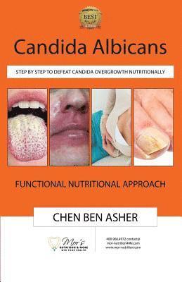 bokomslag Candida Albicans: Step by Step to Defeat Candida Overgrowth Nutritionally