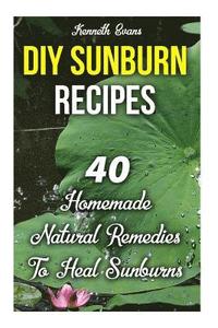 bokomslag DIY Sunburn Recipes: 40 Homemade Natural Remedies To Heal Sunburns