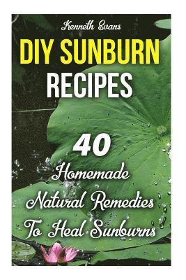 DIY Sunburn Recipes: 40 Homemade Natural Remedies To Heal Sunburns 1