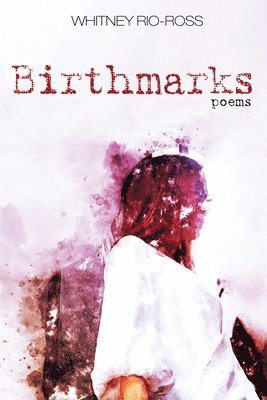 Birthmarks 1