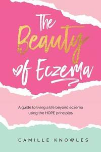 bokomslag The Beauty of Eczema: A Guide To Living a Life Beyond Eczema Using The Hope Principles