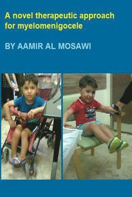 A novel therapeutic approach for myelomeningocele: Pediatric Neurology 1