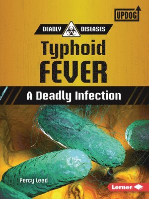 bokomslag Typhoid Fever