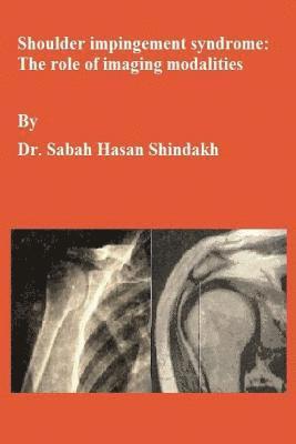 Sabah Hasan Shindakh - Shoulder impingement syndrome: The role of imaging modalities: Master thesis, Häftad