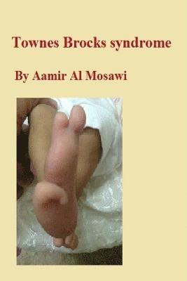 Townes Brocks syndrome: Clinical genetics 1