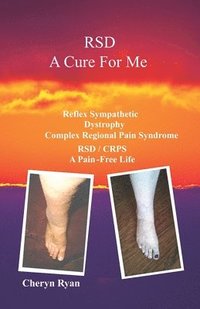 bokomslag Rsd a Cure for Me: Reflex Sympathetic Dystrophy Complex Regional Pain Syndrome Rsd/Crps a Pain-Free Life