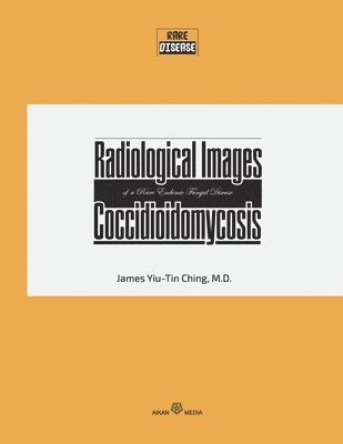bokomslag Radiological Images of a Rare Endemic Fungal Disease Coccidioidomycosis