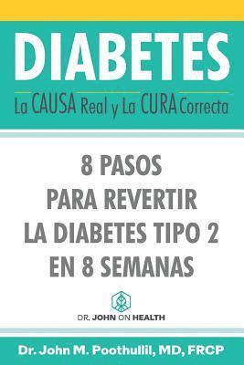 John Poothullil - Diabetes: La Causa Real y La Cura Correcta: 8 Pasos Para Revertir la Diabetes Tipo 2 en 8 Semanas, Häftad