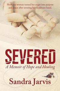 bokomslag Severed