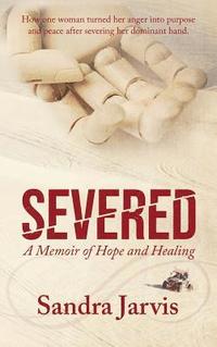 bokomslag Severed: A Memoir of Hope and Healing