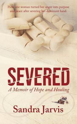 Severed 1