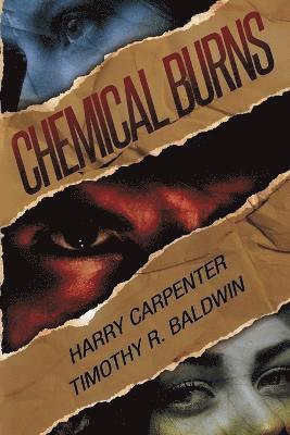 bokomslag Chemical Burns