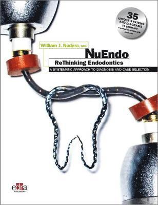 William J. Nudera, William J Nudera - NuEndo ReThinking Endodontics - A systematic approach to diagnosis and case selection, Inbunden